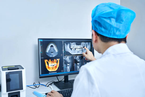 Best Emergency Root Canal Treatment in Cookeville, TN